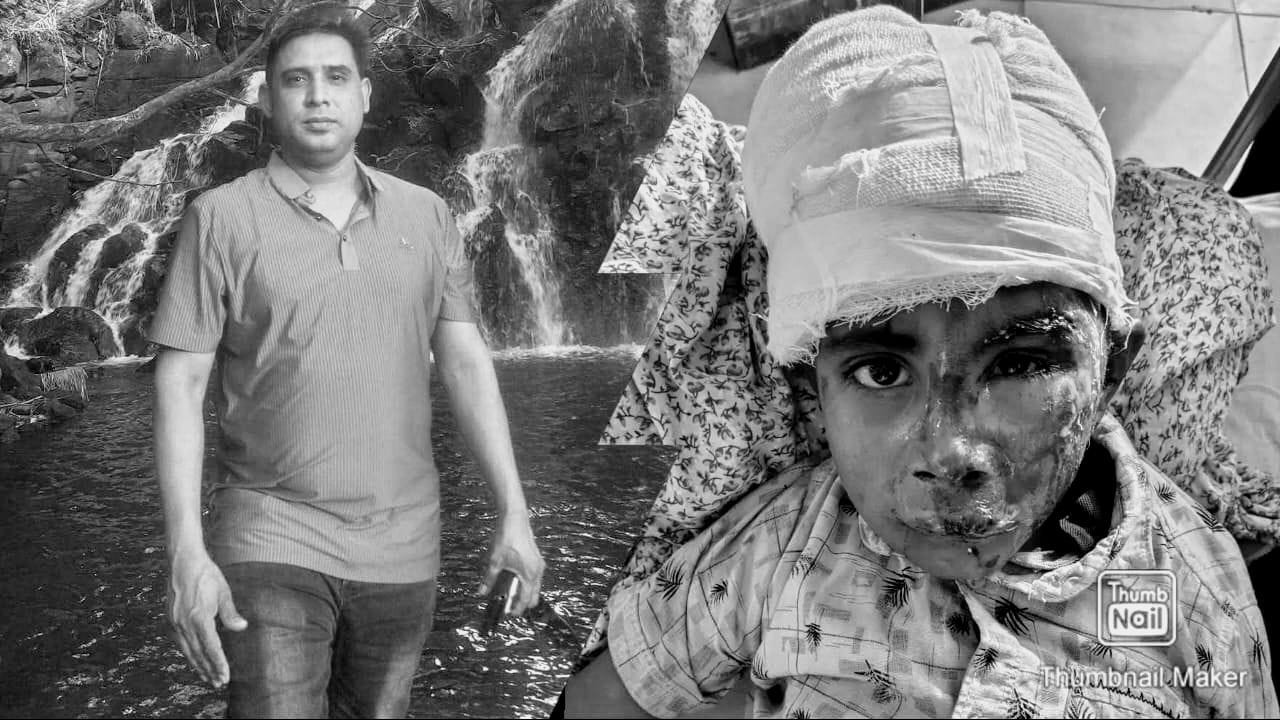 আলফাডাঙ্গায় দুর্ঘটনায় আহত শিশুর পাশে 'মানবতার ফেরিওয়ালা' মরিসাশ প্রবাসী  আকাশ মিয়া